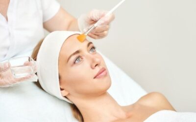 Peeling Químico: Renueva tu Piel y Combate el Acné