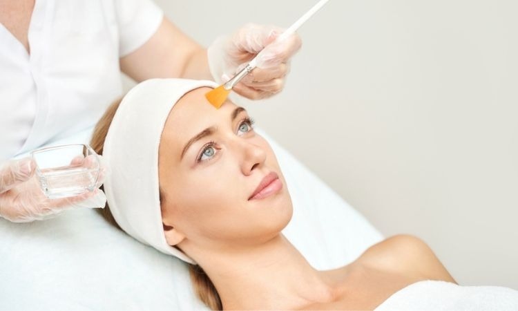 peeling químico