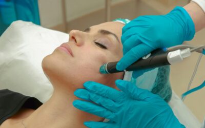 Microneedling: La clave para una piel rejuvenecida
