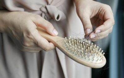 Alopecia areata: Un vistazo profundo a la pérdida de cabello