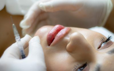 Volumen labial: Todo sobre el ácido hialurónico