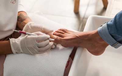 ¿Qué hacer ante la Onicomicosis?